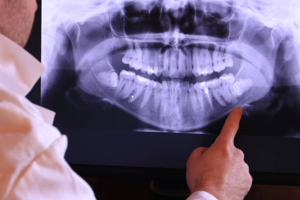 Best Emergency Dental Care for Broken or Chipped Teeth in Tyndall Af, FL