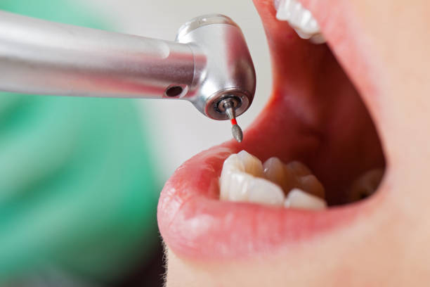 Best Emergency Gum Treatment in Tyndall Af, FL